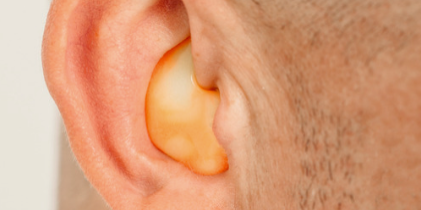 Custom-fitted earplug